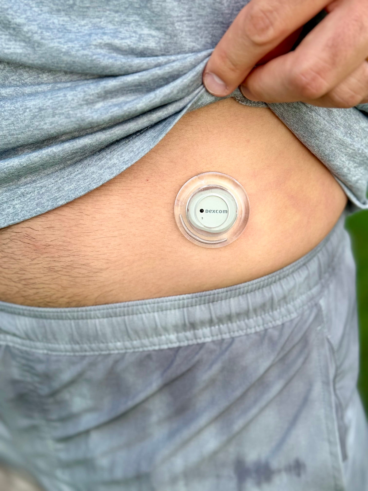 NoLo for Dexcom G7 & Stelo