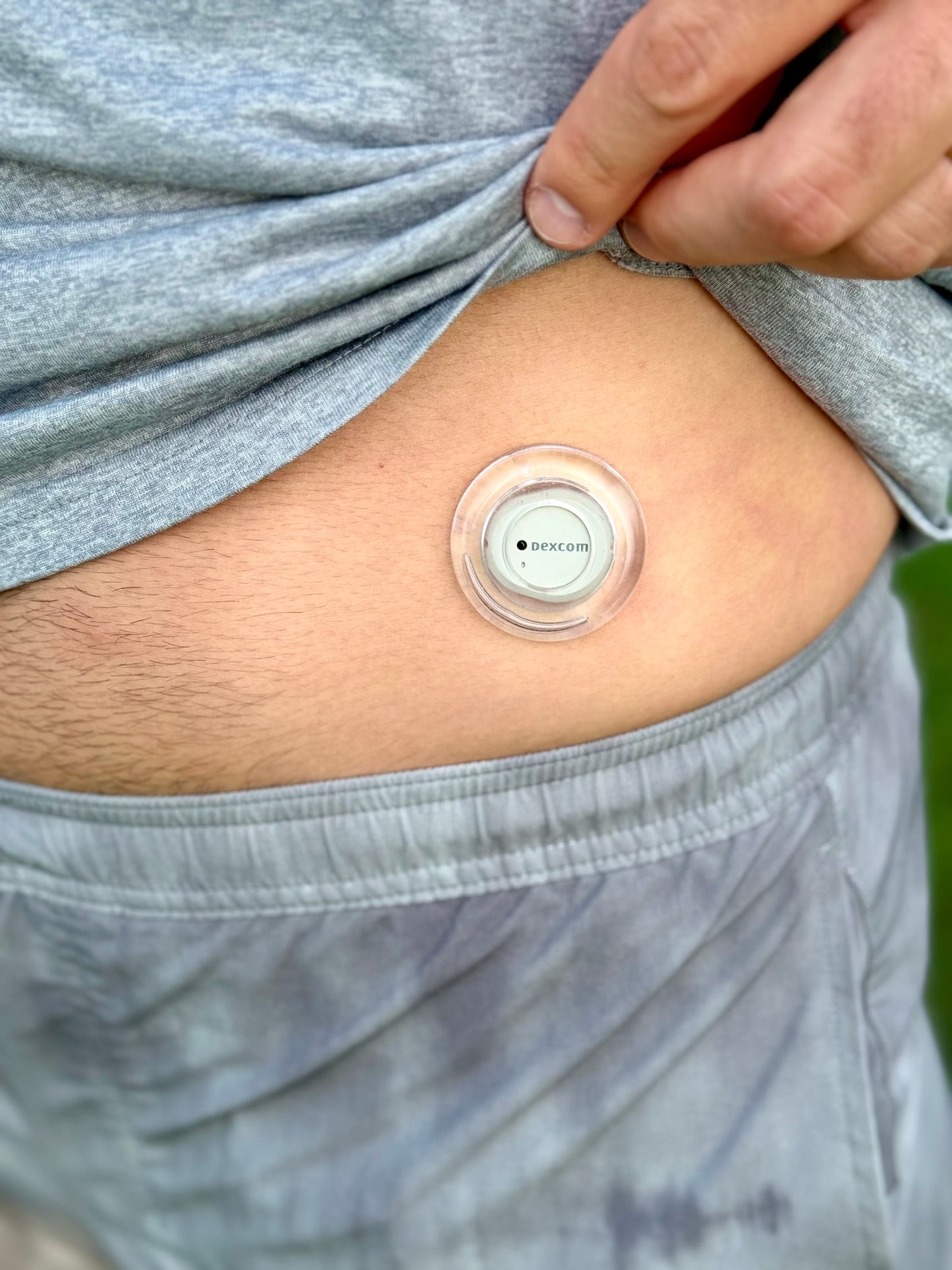 NoLo for Dexcom G7