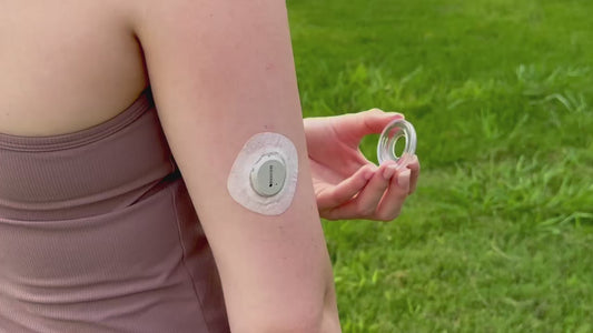 NoLo for Dexcom G7 & Stelo